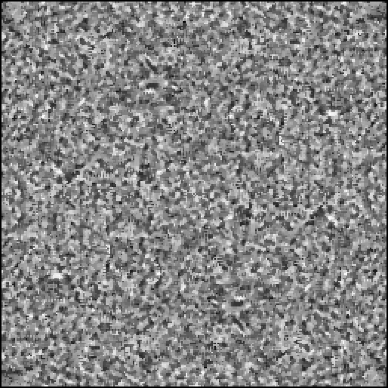 The fibre picture after a median filter of 3 by 3